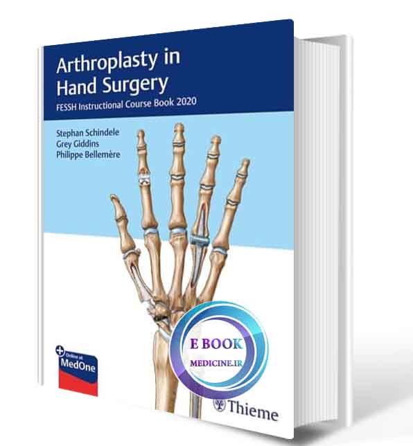 دانلود کتاب Arthroplasty in Hand Surgery: FESSH Instructional Course Book 2020 1st  (ORIGINAL PDF)